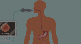 Know more about Endoscopy