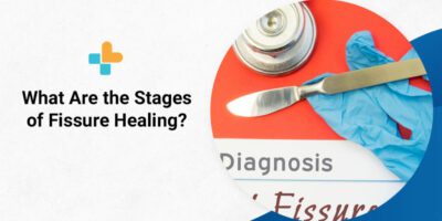stages of fissure healing
