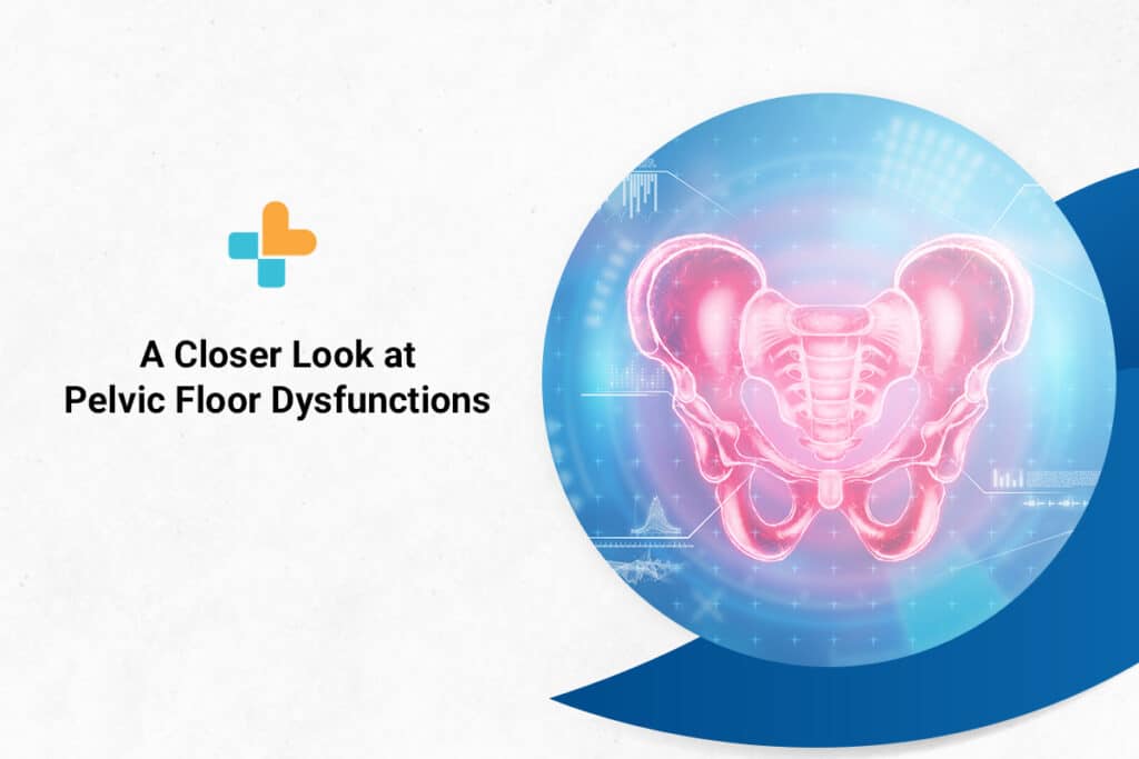 a-closer-look-at-pelvic-floor-dysfunctions