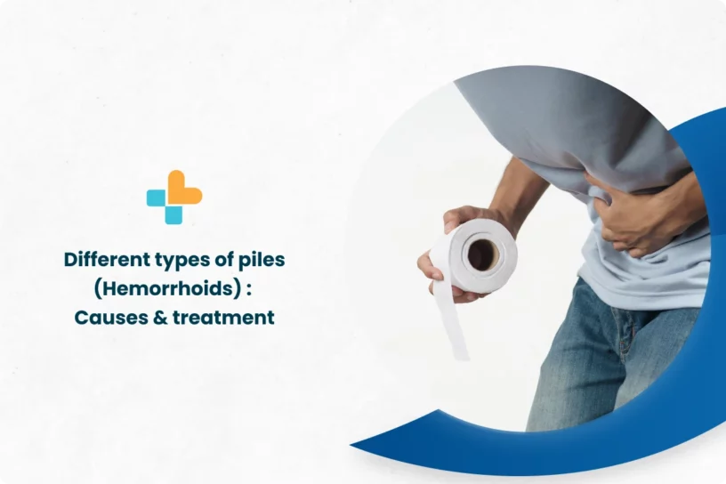 Different-types-of-pilesHemorrhoids-_-Causes-Treatment.