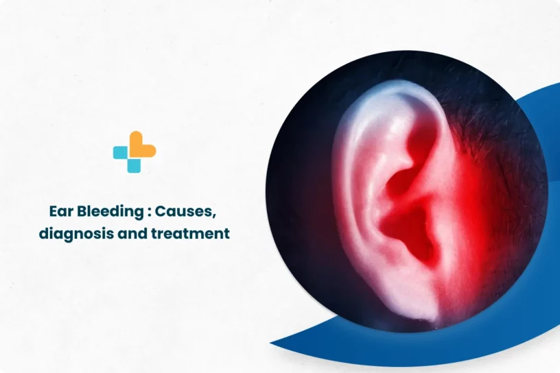 Ear-Bleeding-_-Causes-Diagnosis-and-Treatment