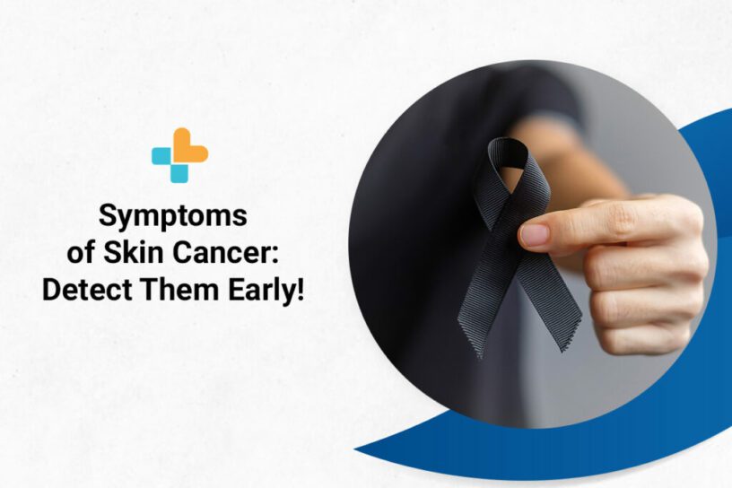 Symptoms of skin cancer