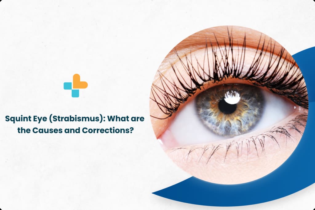 squint-eye-strabismus-what-are-the-causes-and-corrections