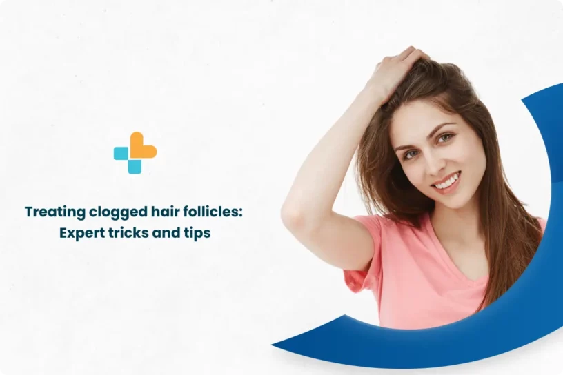 Treating-clogged-hair-follicles