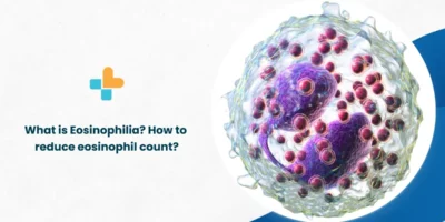 How-to-reduce-eosinophil-count