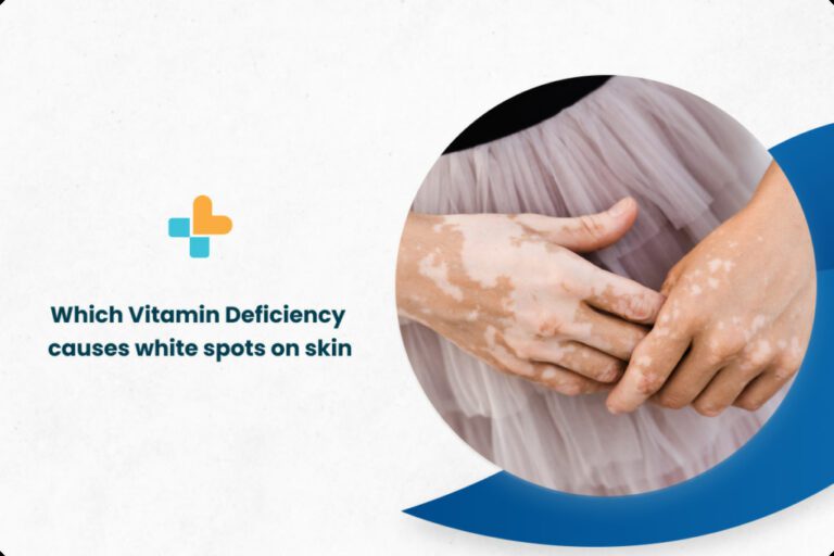 which-vitamin-deficiency-causes-white-spots-on-skin-ayu-health