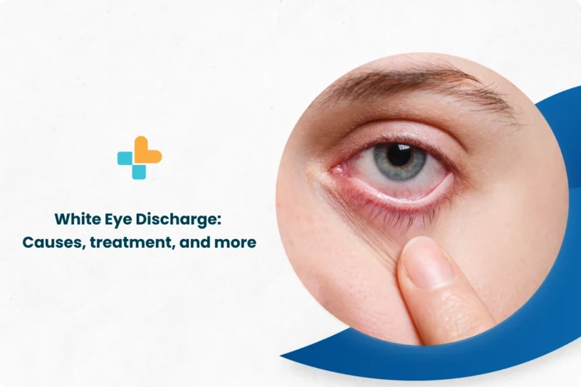 White-Eye-Discharge_-Causes-Treatment-and-More