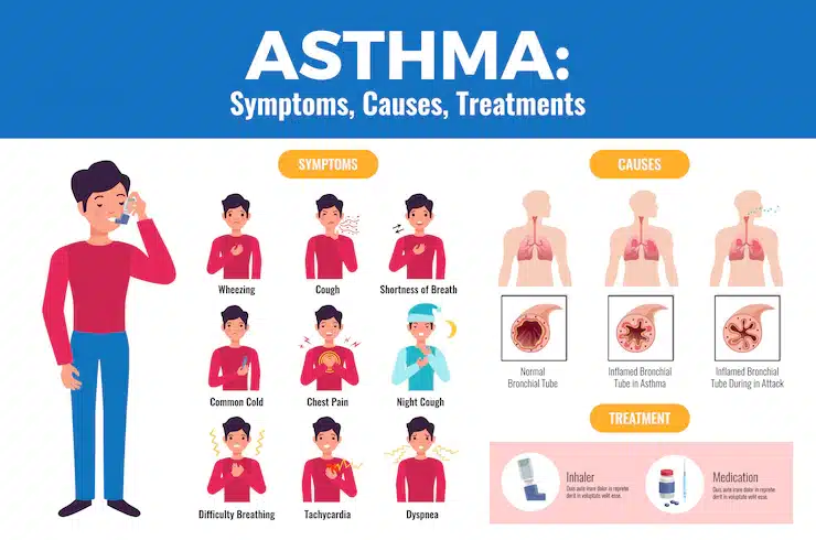 asthmam symptoms causes treatment
