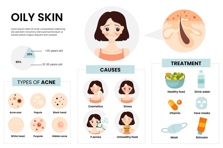 flat hand drawn oily skin problems infographic