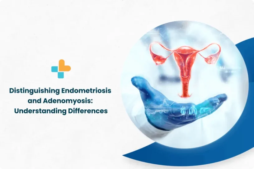 Distinguishing Endometriosis and Adenomyosis Understanding Differences 1024x683 1