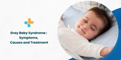 Gray Baby Syndrome Symptoms, Causes and Treatment