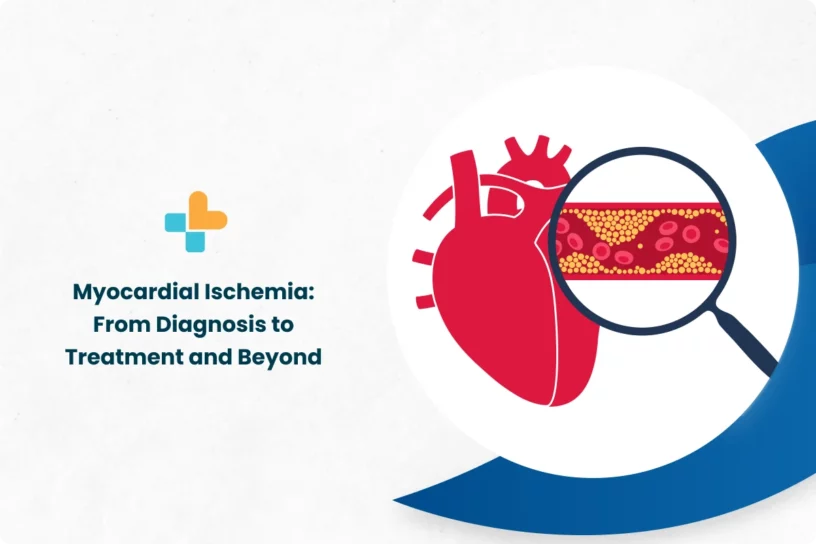 Myocardial-Ischemia_-From-Diagnosis-to-Treatment