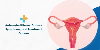 Anteverted Uterus: Causes, Symptoms, and Treatment Options