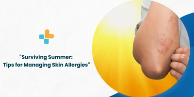 Surviving Summer: Tips for Managing Skin Allergies