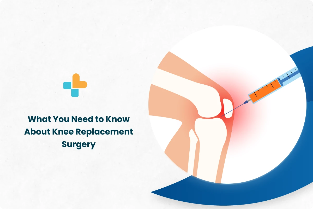 can-you-run-after-knee-replacement-ways-to-decrease-stress-through