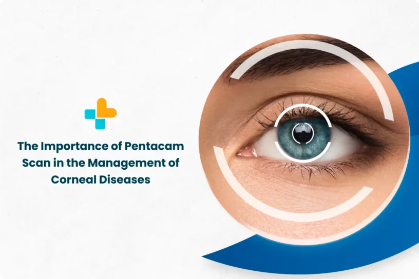 Pentacam Scan in the Management of Corneal Diseases