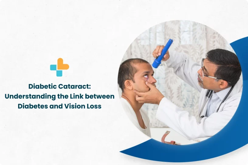 Diabetic Cataract