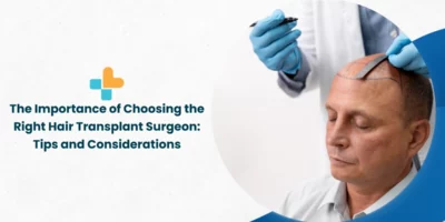 The Importance of Choosing the Right Hair Transplant Surgeon: Tips and Considerations