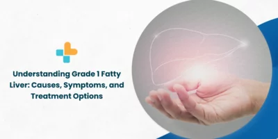 Understanding-Grade-1-Fatty-Liver_-Causes-Symptoms-and-Treatment-Options