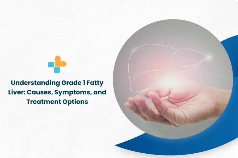 Understanding-Grade-1-Fatty-Liver_-Causes-Symptoms-and-Treatment-Options