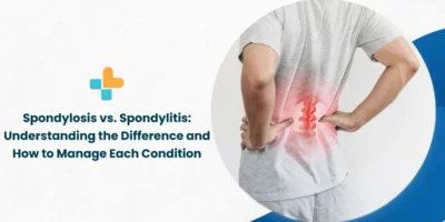 Spondylosis-vs.-Spondylitis_-Understanding-the-Difference-and-How-to-Manage-Each-Condition