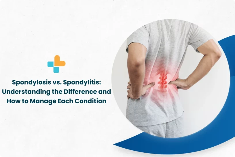 Spondylosis-vs.-Spondylitis_-Understanding-the-Difference-and-How-to-Manage-Each-Condition