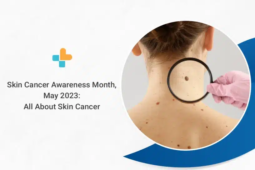 All about Skin Cancer: Symptoms, Risks, Prevention and Treatment