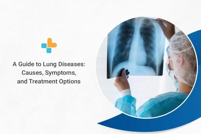Types of Lung Diseases & Their Causes