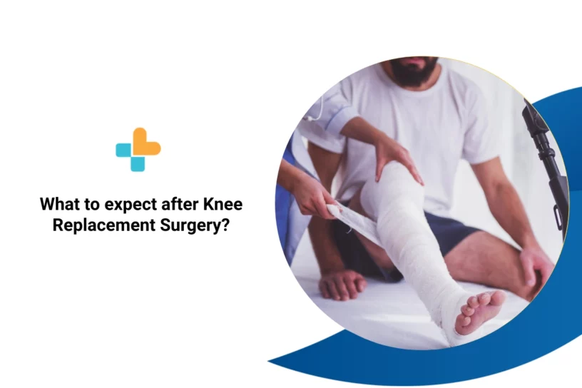 What to expect after Knee Replacement Surgery?