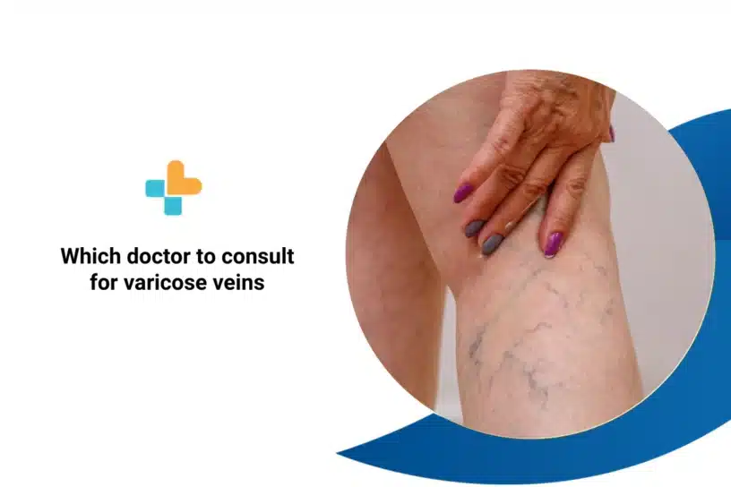 Which Doctor to Consult for Varicose Veins?
