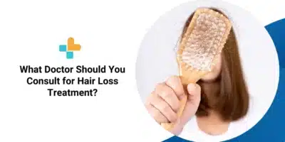 What Doctor Should You Consult for Hair Loss Treatment