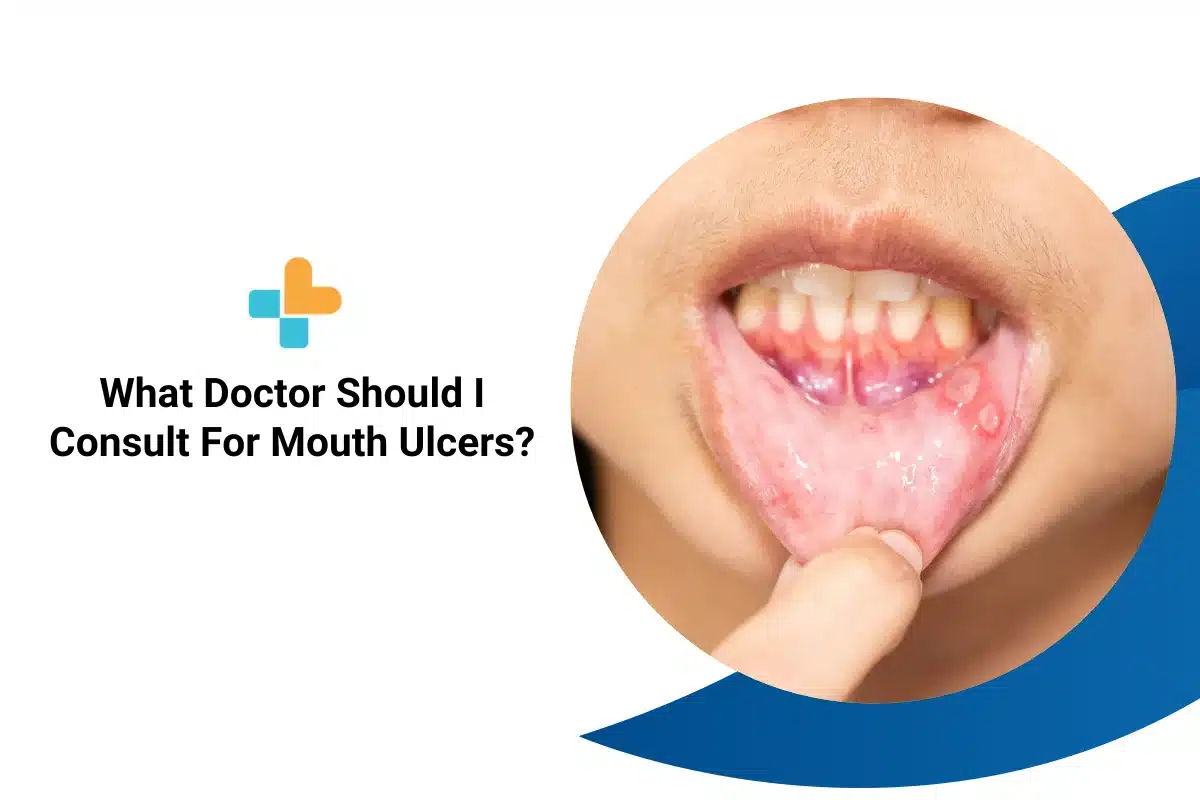 What Doctor Should I Consult For Mouth Ulcers 