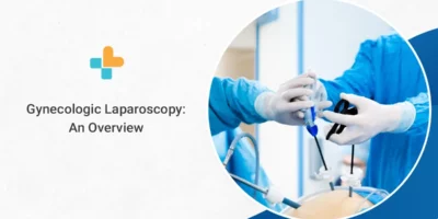 Gynecologic Laparoscopy