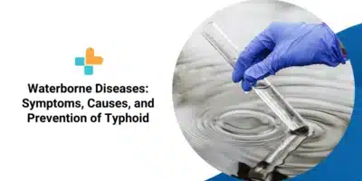 Prevention of Typhoid