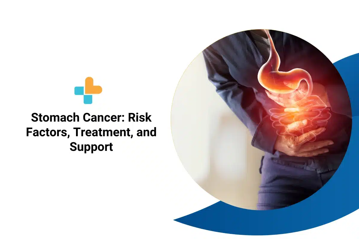 stomach-cancer-risk-factors-treatment-and-support